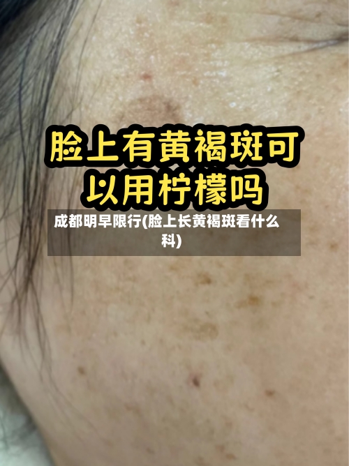 成都明早限行(脸上长黄褐斑看什么科)