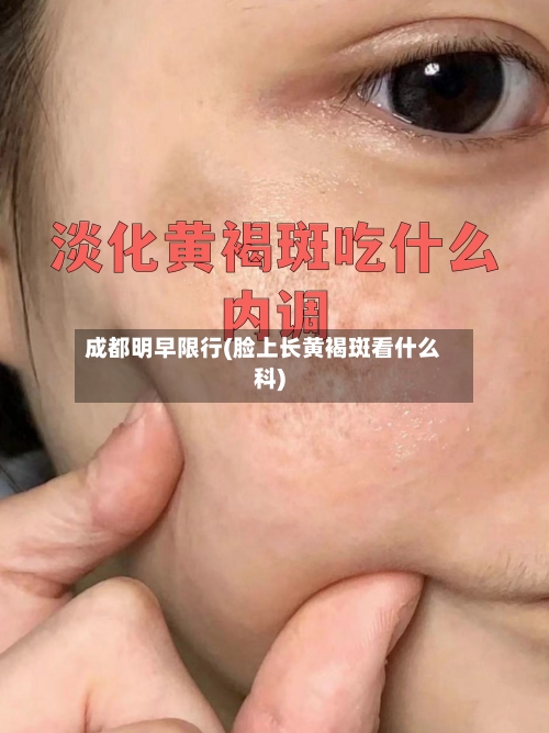 成都明早限行(脸上长黄褐斑看什么科)-第3张图片
