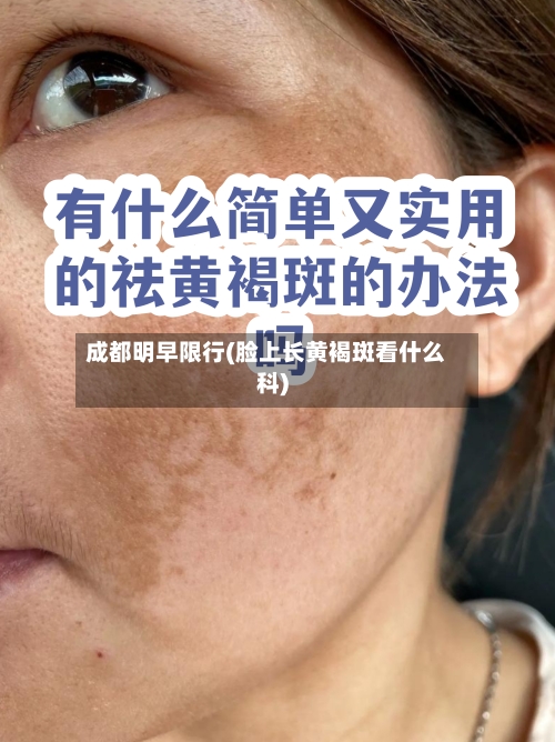 成都明早限行(脸上长黄褐斑看什么科)-第2张图片