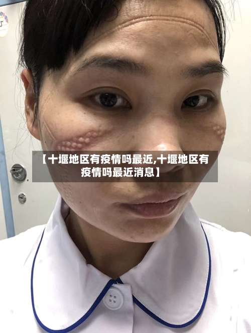 【十堰地区有疫情吗最近,十堰地区有疫情吗最近消息】