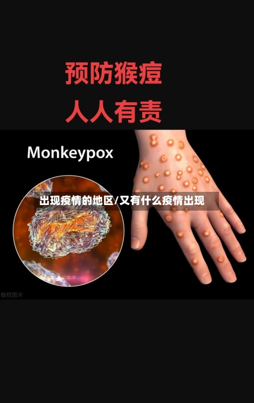 出现疫情的地区/又有什么疫情出现
